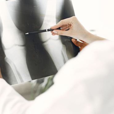 Schwache Knochen und häufige Müdigkeit? Hier sind natürliche Heilmittel wie Glucosaminsulfat